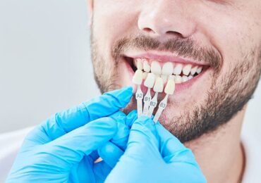 ابتسامة هوليوود