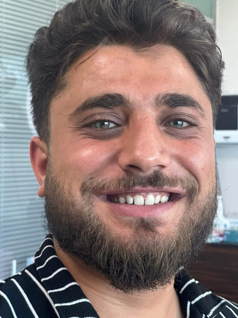 تبييض أسنان