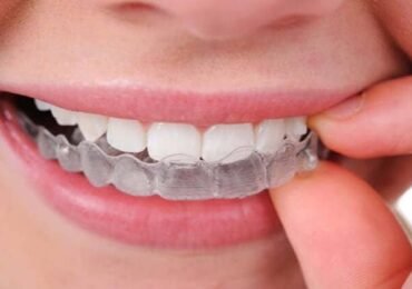 التقويم الشفاف للاسنان في اسطنبول ، تركيا